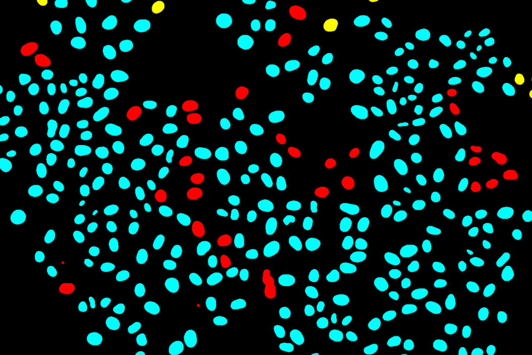 [Translate to chinese:] Separation of cells based on their tracking status: A colourised binary mask of a time-lapse microscopy field of view of medium confluency with individual cells highlighted as survivors if they can be tracked since the initial movie frame (cyan), incomers if they migrated into the field of view throughout the movie (yellow) or mistracks if an error occurred in the automated trajectory reconstruction (red). Tracking_single_cells_using_deep_learning_teaser.jpg