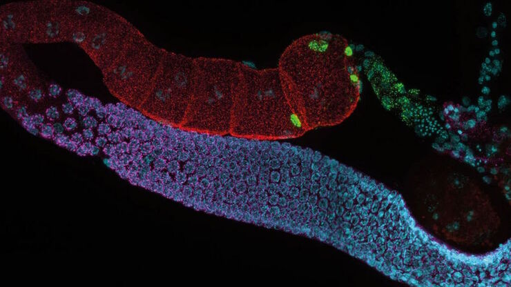 C. elegans adult hermaphrodite gonades acquired using THUNDER Imager. Image courtesy of Prof. Dr. Christian Eckmann, Martin Luther University, Halle, Germany. C. elegans adult hermaphrodite gonades acquired using THUNDER Imager. Staining: blue - DAPI (nucleus), green - SP56 (sperm), red - RME-2 (oocyte), magenta - PGL-1 (RNA + protein granules). Image courtesy of Prof. Dr. Christian Eckmann, Martin Luther University, Halle, Germany.