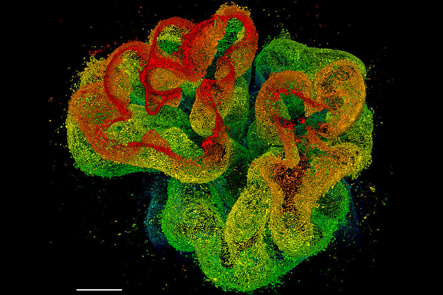 透明化肾组织中肾小球的3D STED 775 纳米深度成像，免疫染色为肾蛋白。
