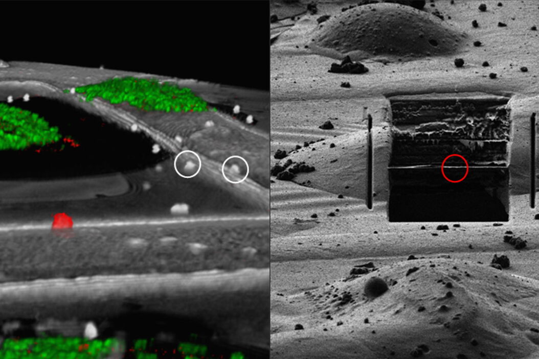 Correlation of markers in the LM and the FIB image. Correlation_of_markers_in_the_LM_and_the_FIB_image_teaser.jpg