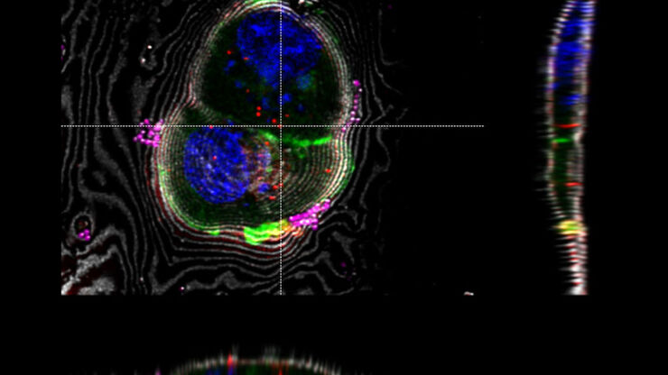 LAS X Coral Cryo: Interpolation based targeting in 3D using sections through the z-stack in x and y direction. The markers can be moved interactively in all relevant windows.