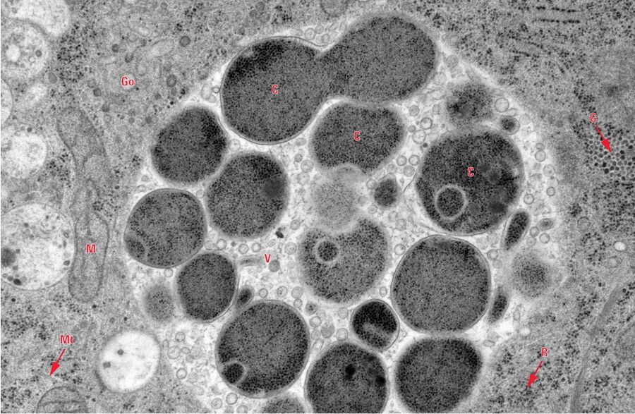 图9：图1中细胞包涵体的高倍放大图。（C）肺炎衣原体细胞；（G）糖原颗粒；（Go）高尔基体；（M）线粒体；（Mt）微管；（R）核糖体；（V）囊泡。比例尺为500 nm。由瑞士苏黎世大学显微镜与图像分析中心的Kaech A提供；相关仪器：Leica EM HPM100。