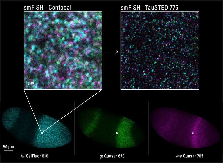 STED 用于发育生物学：果蝇胚胎全标本制备中 RNA 的 smFISH*。 探针被直接标记，没有信号放大。 上图： 三色 TauSTED 775 可捕获 hb CalFluor 610（青色）、gt Quasar 670（绿色）和 eve Quasar 705（紫色）的信号。 下图：整个果蝇胚胎的共聚焦成像。 样本由英国曼彻斯特大学 Tom Pettini 提供。*单分子原位杂交