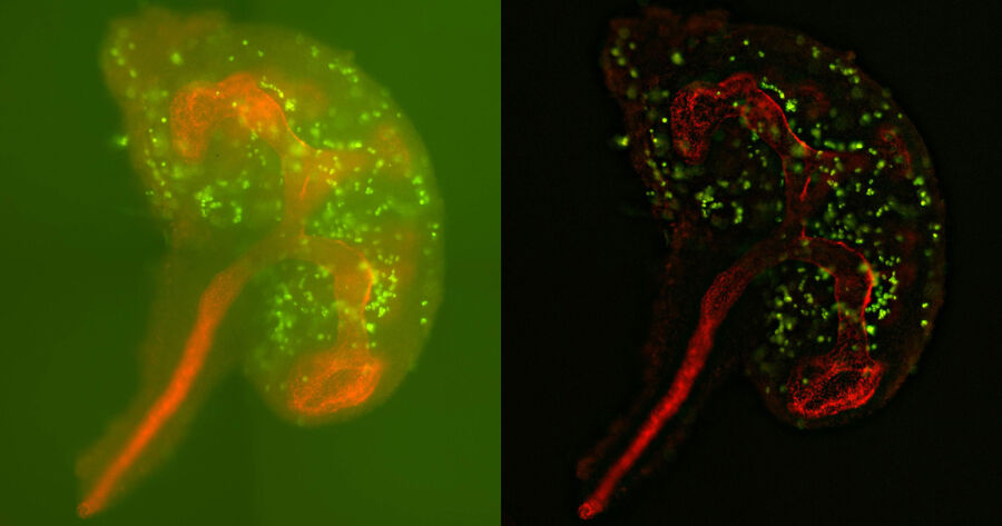 Mouse embryonic kidney at day 12.5. 12.5天大的小鼠胚胎肾脏样本。E-Cadherin(红色)、非特异性(绿色)。样本由芬兰赫尔辛基大学肾脏发育组的Kristen Kurtzeborn硕士制备,并由Satu Kuure教授提供。样本影像由Janne Ylärinne博士,Immuno Diagnostic Oy拍摄。