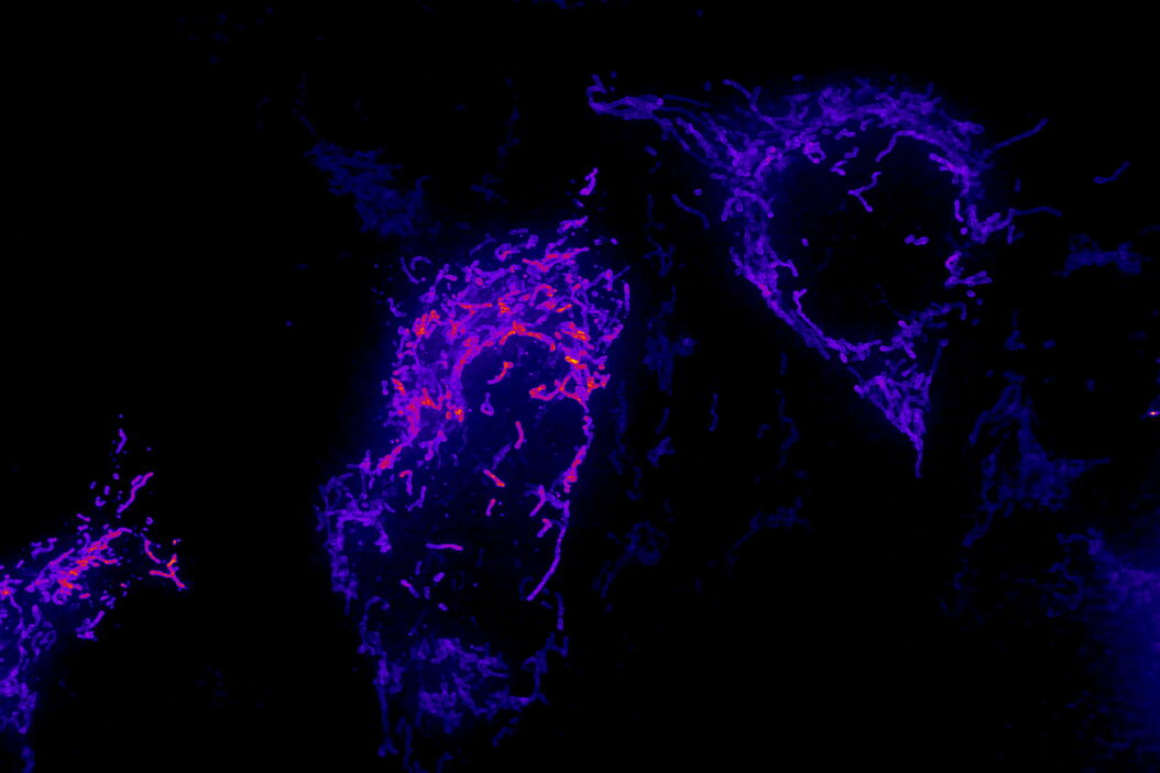 Image of fixed U2OS cell expressing mEmerald-Tomm20 denoised using a 3D RCAN model trained with matching low and high SNR image pairs acquired on an iSIM system. Fixed_U2OS_cell_expressing_mEmerald-Tomm20_Teaser.jpg