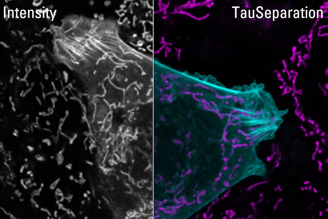 Lifetime-based multiplexing in live cells using TauSeparation. Mammalian cells expressing LifeAct-GFP (ibidi GmbH) and labelled with MitoTracker Green. Acquisition with one detector, intensity information shown in grey. The two markers can be separated using lifetime information: LifeAct-GFP (cyan), MitoTracker Green (magenta). Image acquired with STELLARIS 5. Lifetime-based_multiplexing_in_live_cells_using_TauSeparation.jpg