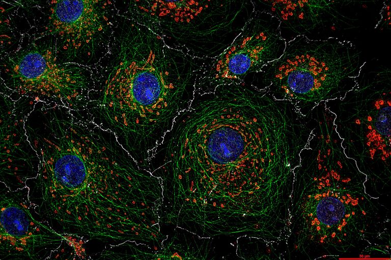 此THUNDER系统图像显示了用DAPI（细胞核）染色的COS7细胞、抗微管蛋白抗体和Mitotracker*（线粒体）以及上皮钙黏素。 样本由德国马尔堡大学Ralf Jacob教授提供