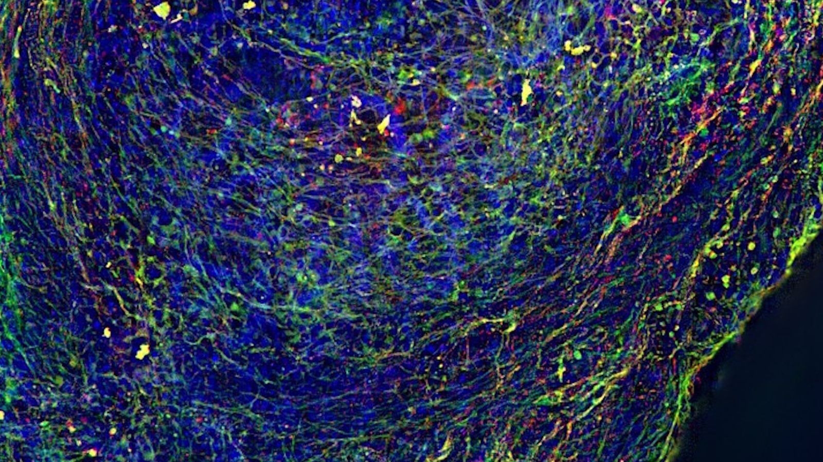 Human iPSC derived mid brain organoid. Stained with MAP2 (green), DAPI (blue) and TH (red). Image acquired using THUNDER Imager Cell Spinning Disk; scale bar 200 µm. Courtesy of Dr Tanya Singh (Salman and Wade-Martins Lab), Department of Physiology, Anatomy and Genetics, University of Oxford.