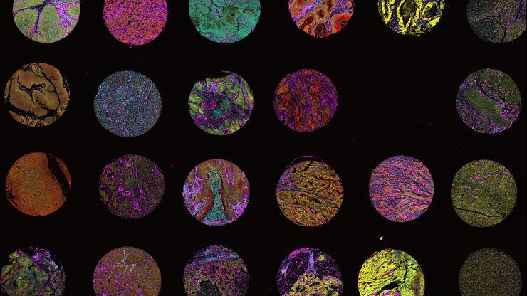 Multi-tissue array with 4 markers shown including DAPI, NaKATPase, PanCk, and Vimentin.