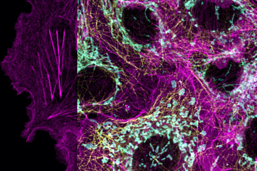 用 SiR-Actin（657 - 740 纳米检测范围）、AF750-Tom20（760 - 790 纳米）、AF790-Tubulin（810 - 850 纳米）标记的 Cos-7 细胞。