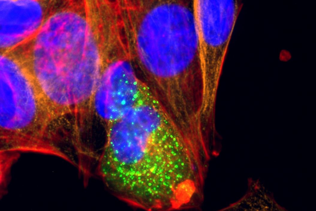 U2OS cells transfected with an Mx1-GFP plasmid (signal enhanced using Alexa Fluor 488-conjugared anti-GFP antibody) and co-stained for nuclear DNA (Hoechst 33342), microtubules (Alexa 555) and F-actin (ATTO 643). Image was captured on Mateo FL. U2OS_cells_enhanced_co-stained_for_DNA_microtubules_F-actin.jpg