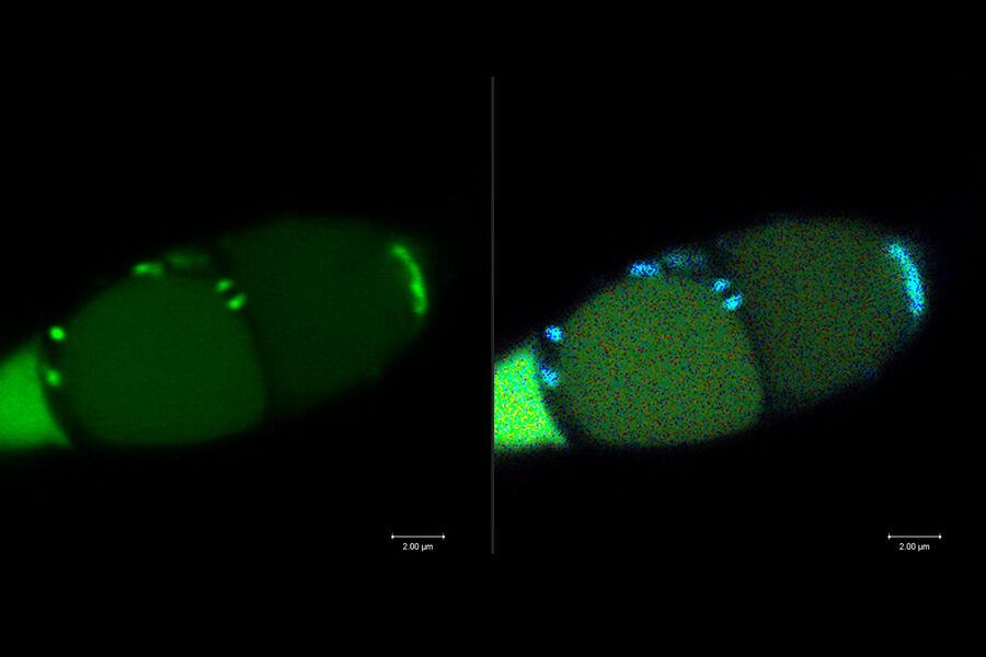 [Translate to chinese:] Mitochondria-localized GFP in Magnaporthe Oryzae (Rice blast fungus)