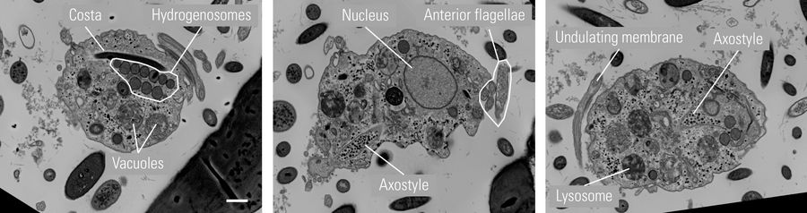 Trichomonas sp. in mouse gut, OTO embedding and serial sections for array tomography. SEM images of representative sections with relevant organelles. Sample courtesy Isabelle Guerin-Bonne, Low Kay En, Electron Microscopy Unit, Yong Loo Lin School of Medicine, National University of Singapore.