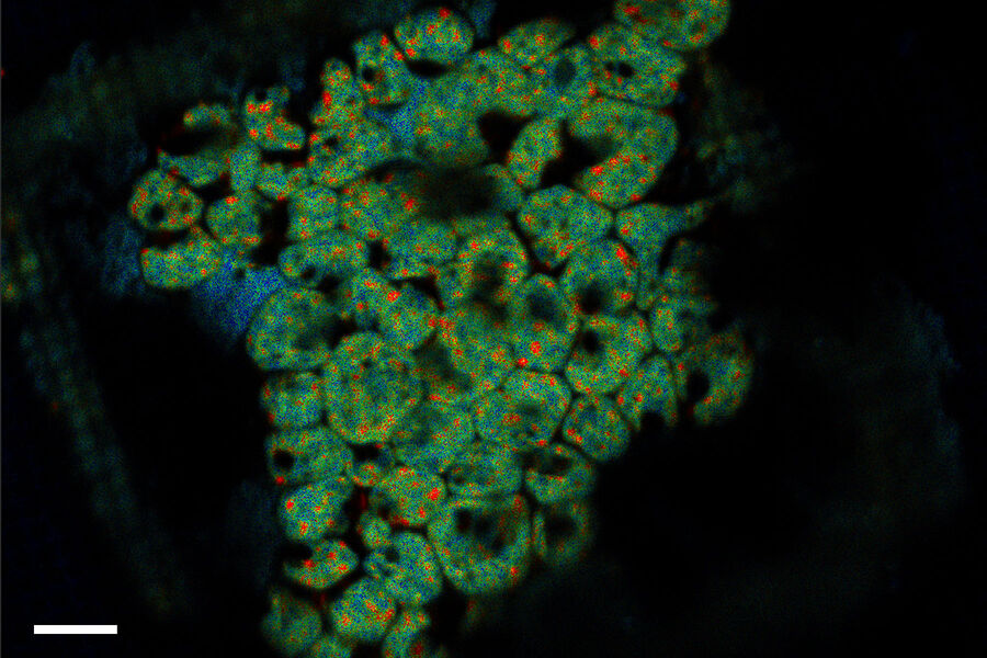 Clamydomonas TauSense Scalebar 10µm