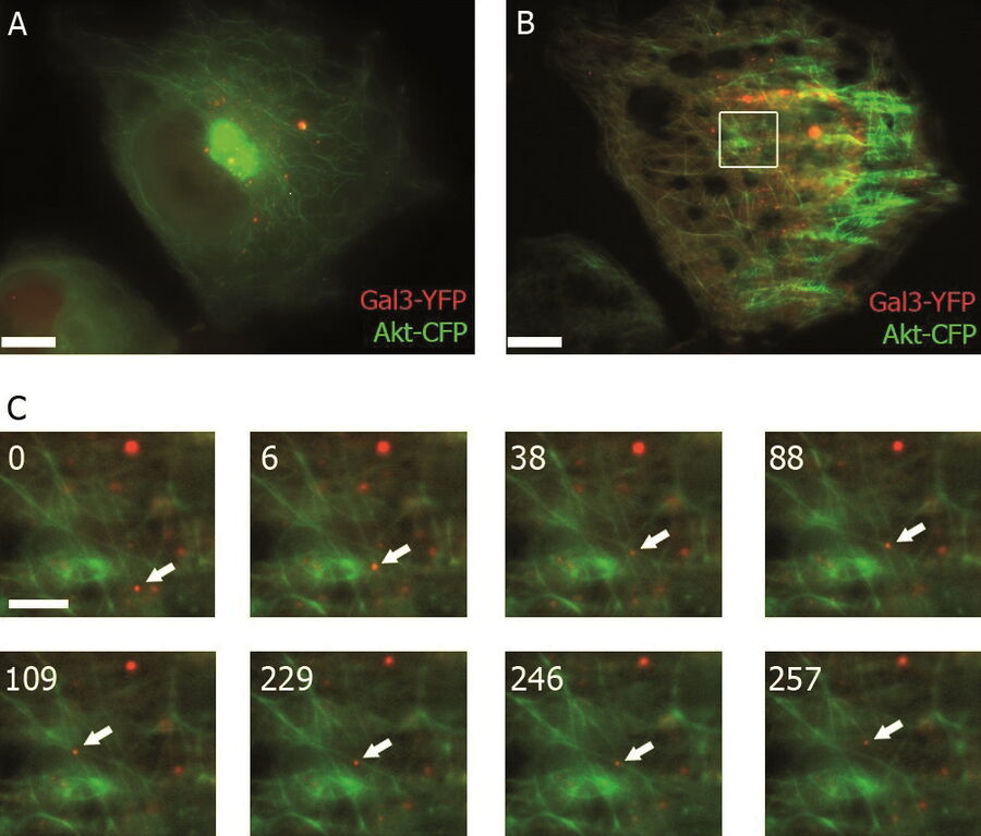 Overview image with epifluorescence/TIRF