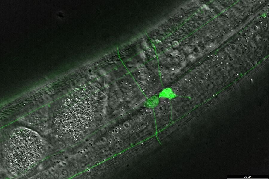 Transgenic C. elegans worm expressing GFP (green fluorescent protein). Thunder image courtesy of L. Ma, School of Life Sciences, Central South University, China.