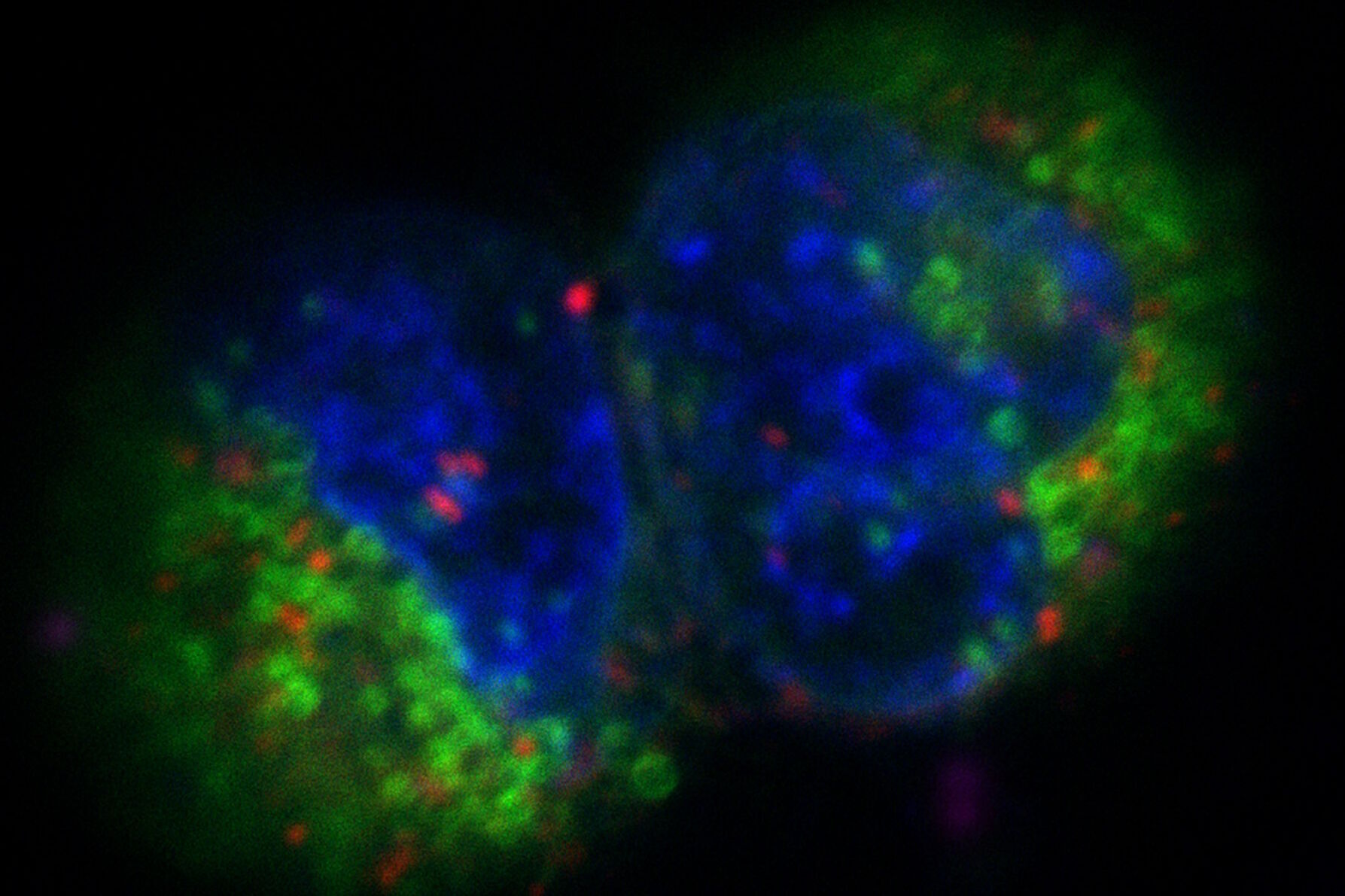 图3：共聚焦Z-堆栈的投影。Sum159细胞和乳腺癌细胞由德国海德堡欧洲分子生物学实验室（EMBL）Mahamid Group的Ievgeniia Zagoriy提供。蓝色- Hoechst -表示细胞核，绿色- MitoTracker Green-线粒体，红色- Bodipy -脂质滴。