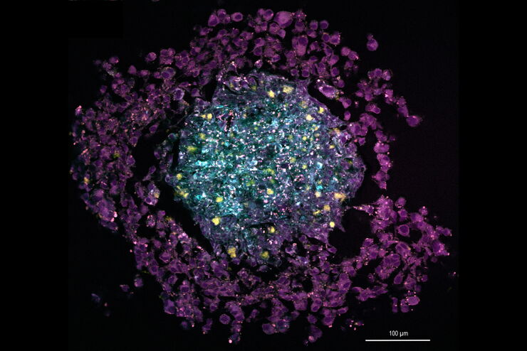 Multi-color SRS image of tri-cellular cancer spheroid showing total lipids (yellow, 2850 cm-1), unsaturated lipids (magenta, 3050 cm-1), collagen (SHG, cyan). Sample courtesy of R. Rudolf, J Klicks, Hochschule Mannheim Multi-color SRS image of a tri-cellular cancer spheroid