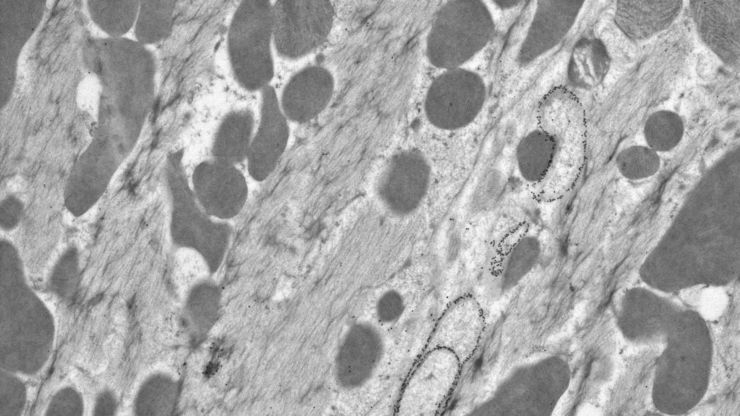 Mouse heart. Courtesy of Riet De Rycke, University of Ghent, Belgium.