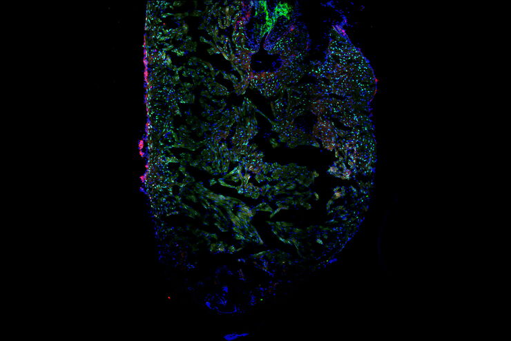 [Translate to chinese:] Zebrafish heart showing the ventricle with an injury in the lower area