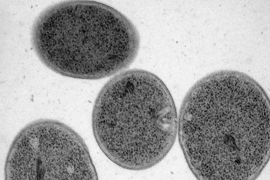 Freeze substitution of Pseudomonas deceptionensis (courtesy of Lopez-Iglesias C, Delagado L and Mercade E, CC i-University Barcelona, Science Park); related instrument: Leica EM SPF.