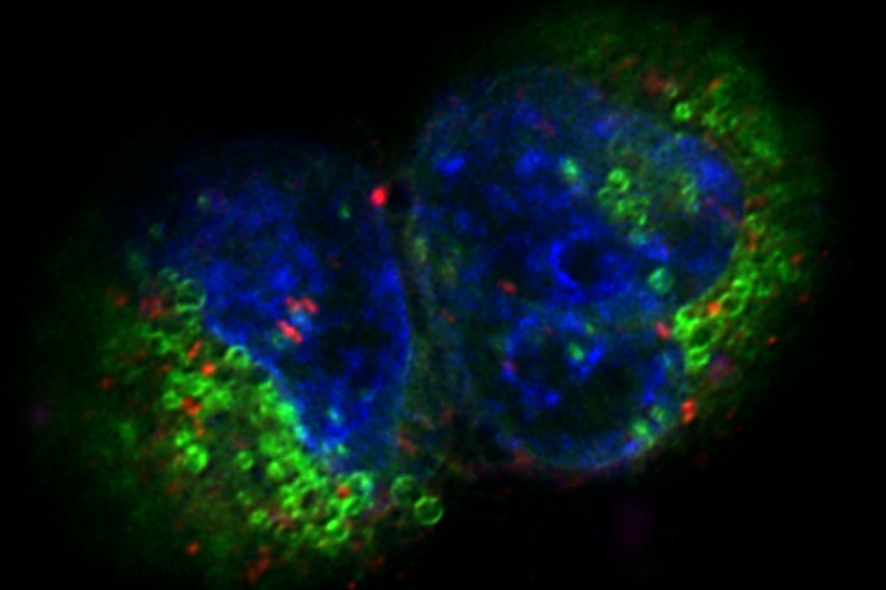 [Translate to chinese:] Projection of a confocal z-stack. Sum159 cells, human breast cancer cells kindly provided by Ievgeniia Zagoriy, Mahamid Group, EMBL Heidelberg, Germany. Blue–Hoechst - indicates nuclei, Green–MitoTracker Green–mitochondria, and red–Bodipy - lipid droplets