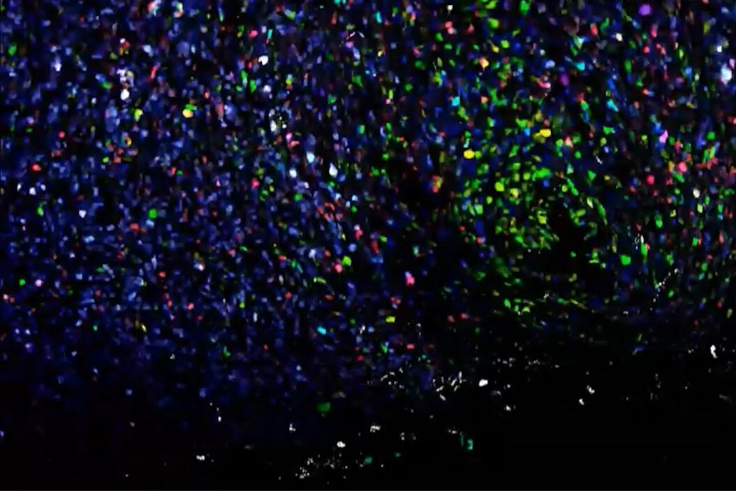 Application example of hyperspectral imaging Application example of hyperspectral imaging TNBC_LeGO_primary_tumor.jpg