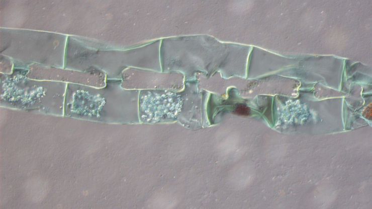 Spirogyra algae (Conjugation), Transmitted Light Differential Interference Contrast.