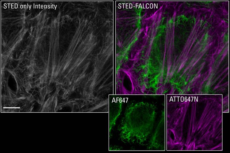 STED-FLIM 用于细胞生物学： STED 775 和 FALCON 自动相量分离技术可以利用不同荧光的寿命来分离具有重叠光谱的荧光种类。 在标记了波形蛋白和肌动蛋白的 HEK 细胞中，单纯的光子计数强度信息（灰色）显示两种结构没有区别，而 STED-FLIM （绿色，波形蛋白AF647；紫色，Actin ATTO 647N-phalloidin）可以明显区分它们。 比例尺： 4微米。 样本由德国杜塞尔多夫 CAI 的 Sebastian Hänsch 和 Stephanie Weidtkamp-Peters 提供。