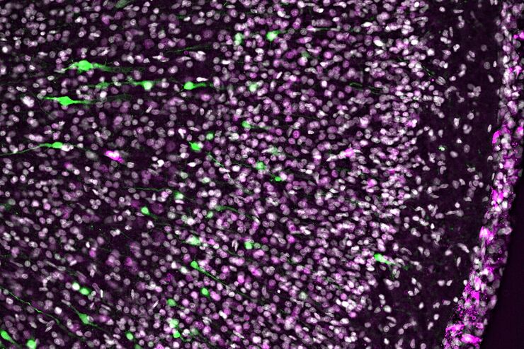 [Translate to chinese:] Electroporated nerve cells (green), specific neuronal markers (magenta) and cell nuclei (white), computational cleared.