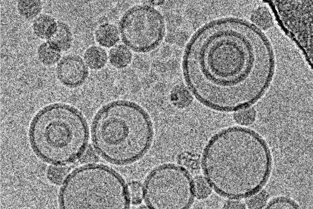 Cryo-electron micrographs of subviral particles of a common cold virus bound to liposomes, acquired under low dose conditions at 300 kV with a CCD-camera. Subviral_particles_of_common_cold_virus_at_high_underfocus_teaser.jpg