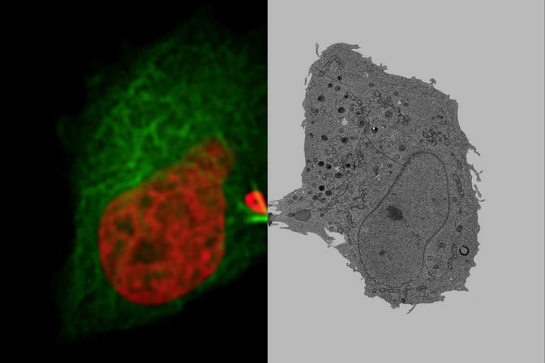 表达H2B-mCherry与αTubulin-mEGFP的哺乳动物细胞（分别用于标记DNA与微管结构）在胞质分裂启动60分钟后通过高压冷冻技术实现冷冻固定。经冷冻置换和树脂渗透处理后，利用透射电镜对细胞间桥结构进行成像观测。