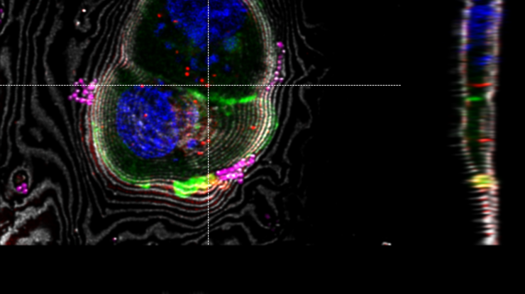 LAS X Coral Cryo：基于插值法的三维目标定位，使用 x 和 y 方向的 Z 叠切面。标记可在所有相关窗口中交互移动。