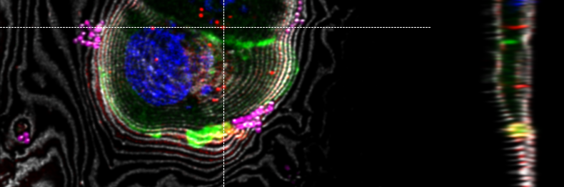 LAS X Coral Cryo：基于插值法的三维目标定位，使用 x 和 y 方向的 Z 叠切面。标记可在所有相关窗口中交互移动。