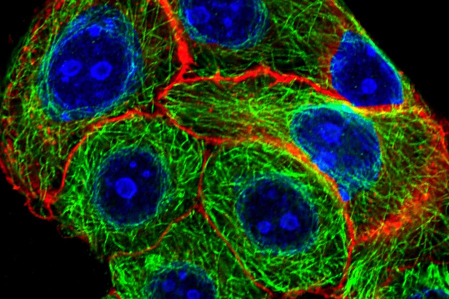 甲醇固定的 MDA-MB-468 细胞图像，其中 EGF 受体用 AZ-271 标记的 affibody（红色）染色，Ki67 用抗 Ki67 的兔 IgG（一级）染色，ATTO-647N 标记的抗兔的驴 IgG-fab2-片段（二级，蓝色）染色，管蛋白抗体用抗 beta 管蛋白的鼠 IgG（一级）染色，ATTO 488 标记的抗鼠的驴 IgG-fab2-片段（二级，绿色）染色、蓝色）、小鼠 IgG 抗 beta 管蛋白抗体染色（一级）和 ATTO 488 标记的驴 IgG-fab2-片段抗小鼠抗体染色（二级，绿色）。