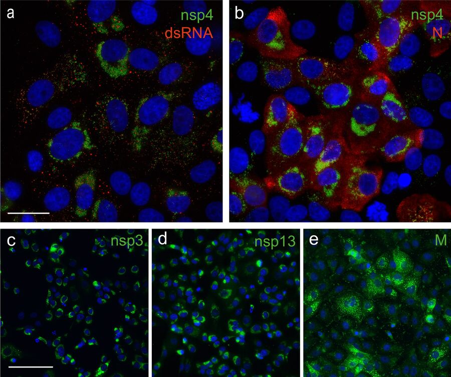图3: SARS-CoV-2感染VeroE6细胞后用兔SARS-CoV抗血清处理的免疫荧光显微镜。Nsps位于细胞核附近，M蛋白位于高尔基体。抗dsRNA抗体用于标记病毒RNA合成的复制中间产物。细胞核用Hoechst染色。（a）和（b）的比例尺为25 μm；（c）、（d）和（e）的比例尺为100 μm。图片来源：Ogando et al., Journal of General Virology (DOI 10.1099/jgv.0.001453)。