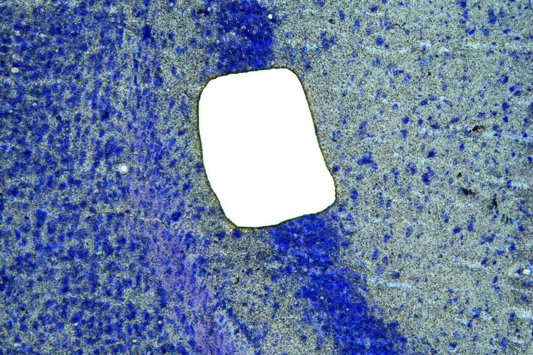 Image of murine-brain tissue showing a region removed with UV laser microdissection. Murine-brain_tissue_showing_a_region_removed_with_UV_LMD.jpg