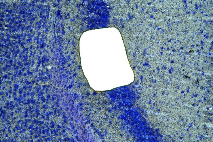 Image of murine-brain tissue showing a region removed with UV laser microdissection.