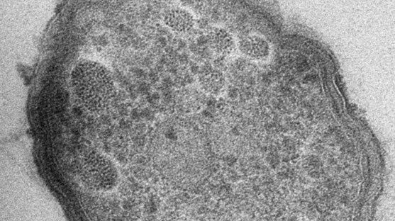Acidithiobacillus sp. HV2/2. Courtesy of Dr. Andreas Klingl, University of Marburg, Germany. 
