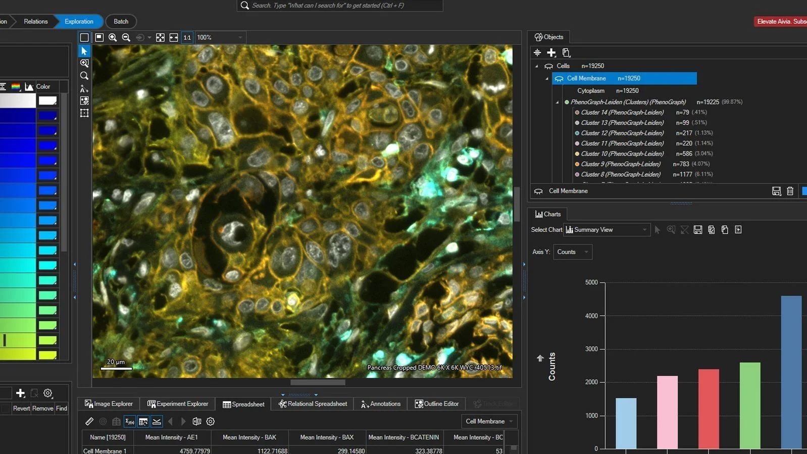 用 Aivia AI 图像分析软件分析胰腺导管癌组织切片。测量选择器可动态更新图表，并允许快速浏览多个测量结果，从而实现快速洞察。