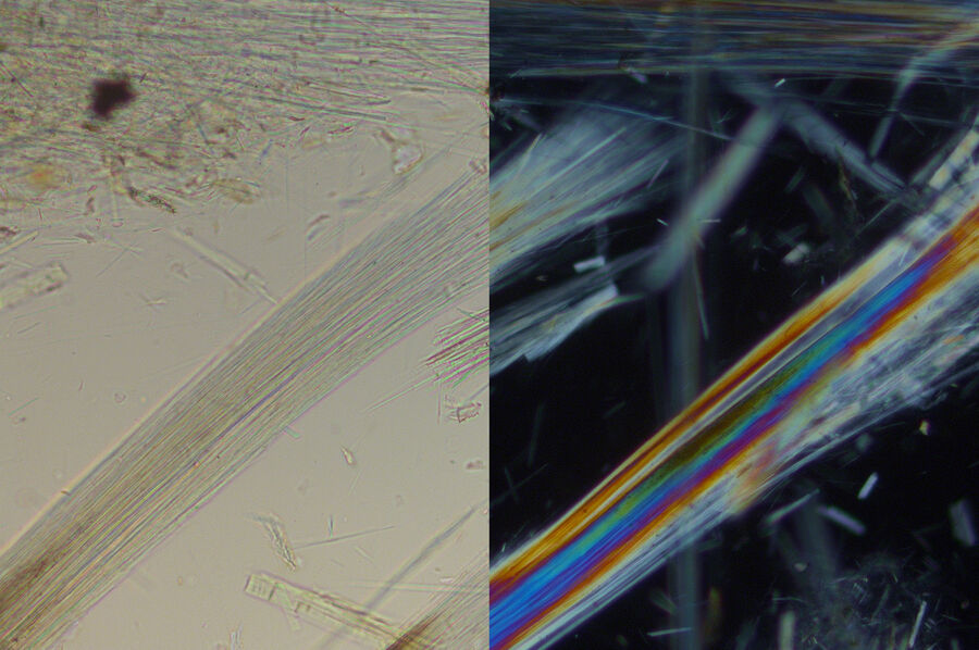 左：纤维状阳起石平行偏振器成像。右：用交叉偏镜拍摄的阳起石样本。阳起石纤维显示出明显的双折射颜色，这明显区别于玻璃纤维（无双折射）。DM4P显微镜使用透射光、20x N平面DS（色散染色）物镜和偏光镜的成像效果