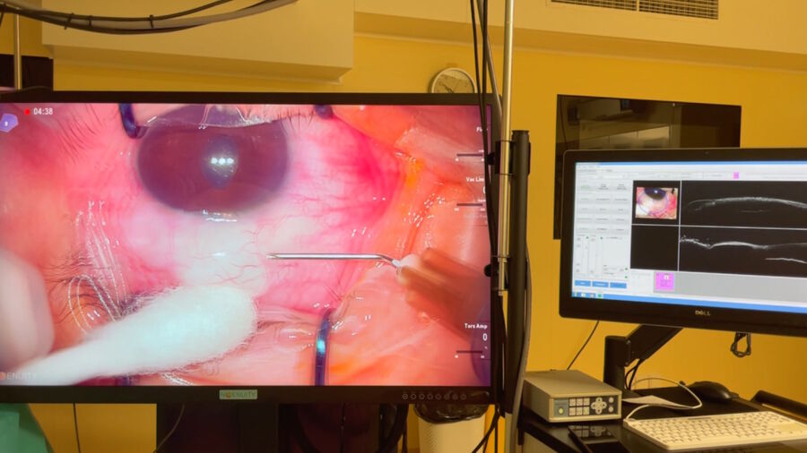 手术在三维可视化系统屏幕上显示，术中 OCT 支持两个不同平面的可视化。图片由 Ozana Moraru 博士提供。