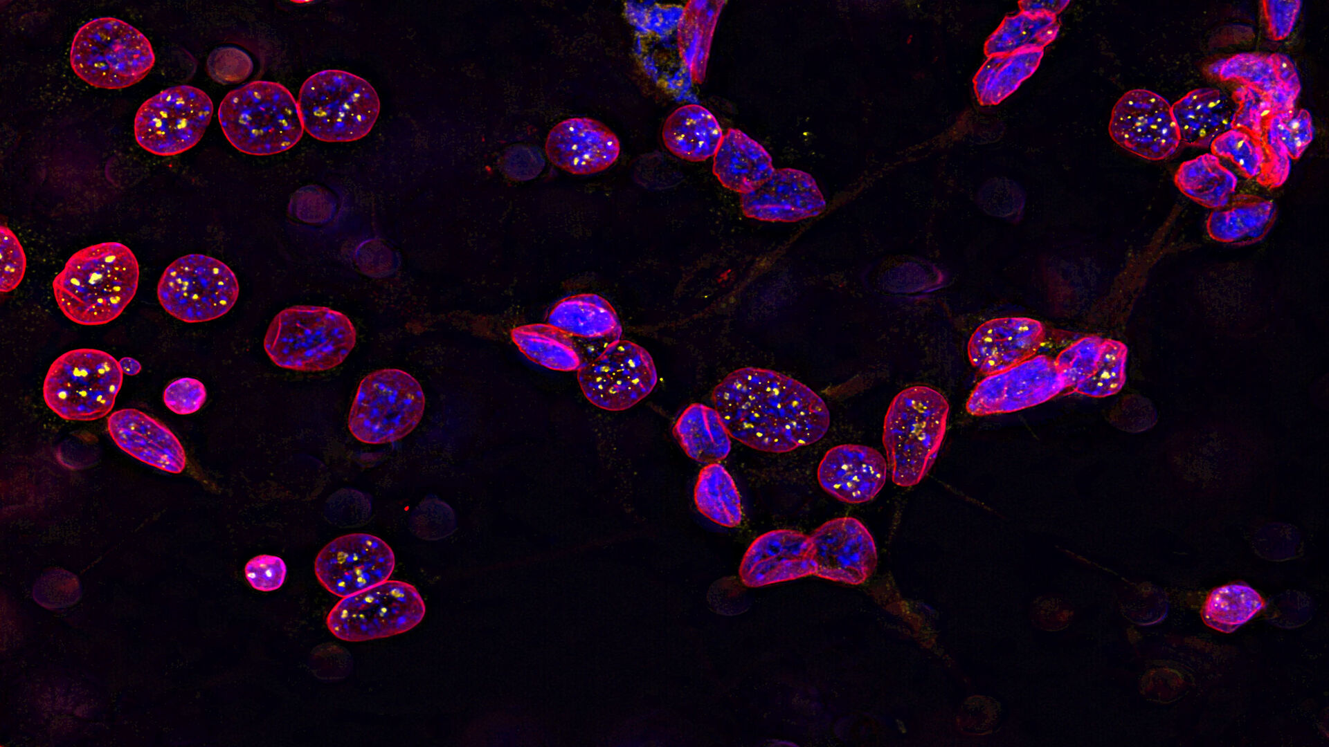 Image of C2C12 cells: The cells are stained with lamin B (magenta) which indicates nuclear structure, Hoechst (blue) indicating DNA, and γH2AX (yellow) indicating damage to DNA. Cells were imaged using a THUNDER Imager 3D Live Cell with a 63X/1.4 oil immersion objective.