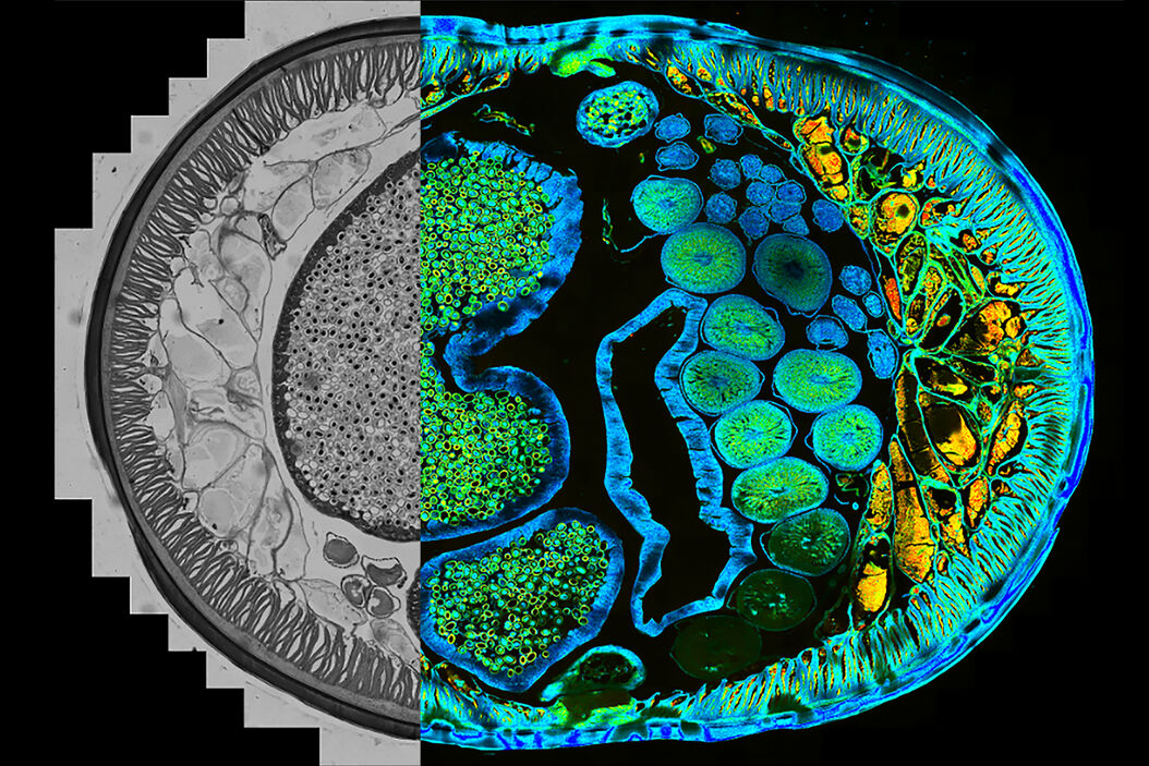 Identification of distinct structures_roundworm_Ascaris_female Identification_of_distinct_structures_roundworm_Ascaris_female.jpg