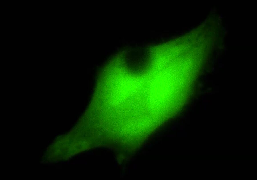 Some microscopy techniques demand the simultaneous coupling of additional light sources or lasers. For example, bleaching during FRAP experiments is done using a laser coupled into the infinite light path.