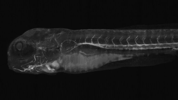Light sheet microscopy tilescan of zebrafish. 