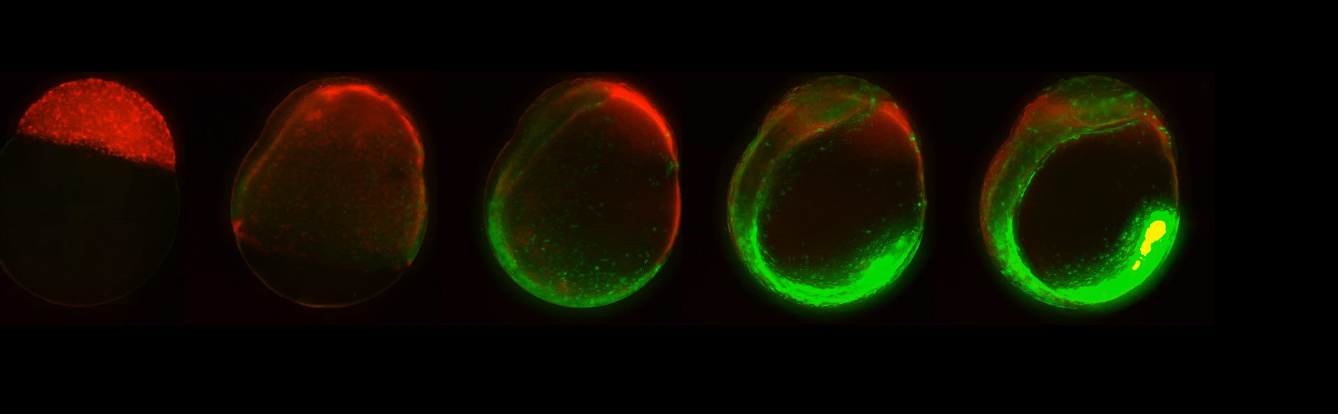 Developing Zebrafish embryo