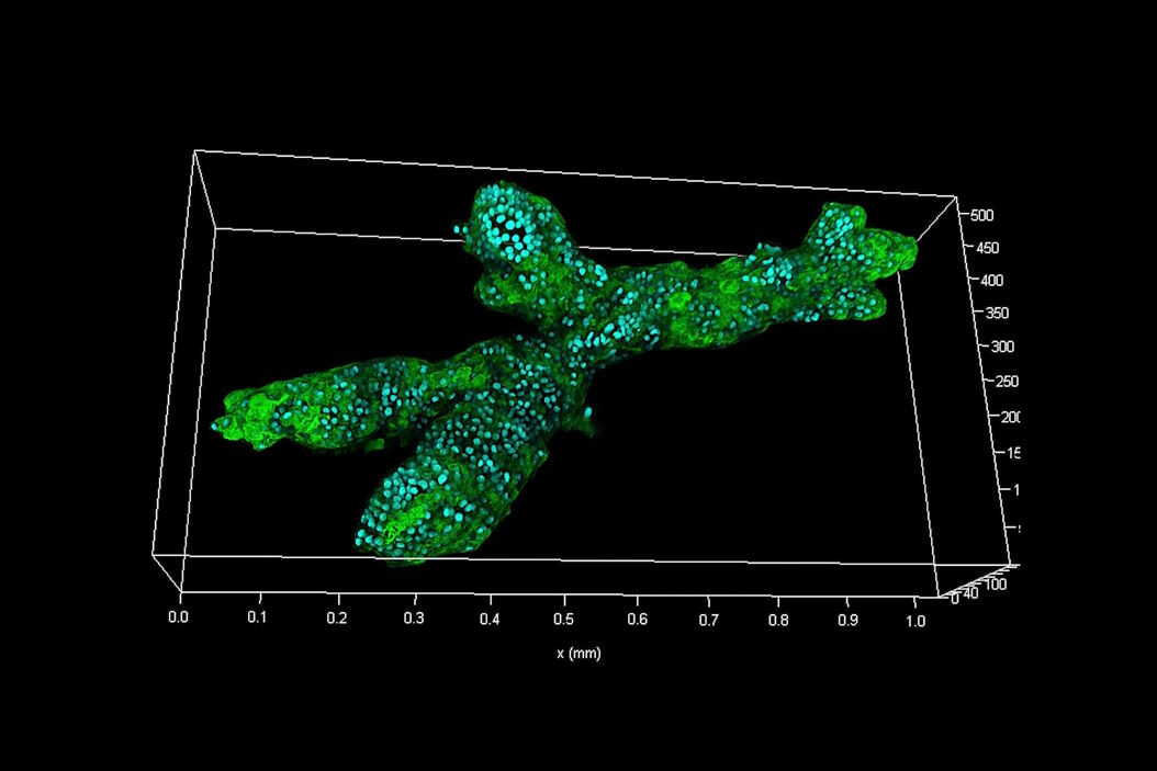 [Translate to chinese:] Branched organoid growing in collagen where the Nuclei are labeled blue. To detect the mechanosignaling process, the YAP1 is labeled green. Branched_organoid_growing_in_collagen.jpg