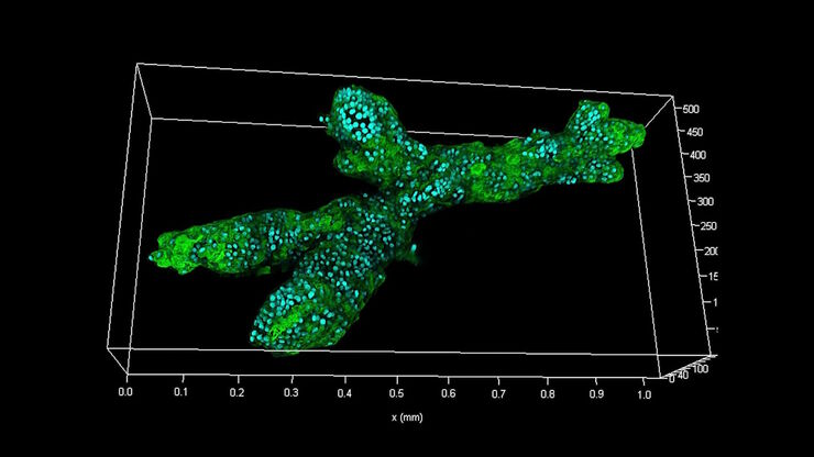 Branched organoid growing in collagen where the Nuclei are labeled blue. To detect the mechanosignaling process, the YAP1 is labeled green. Branched organoid growing in collagen where the Nuclei are labeled blue. To detect the mechanosignaling process, the YAP1 is labeled green.