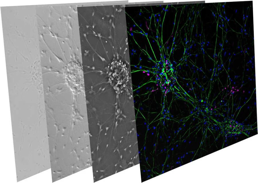Image series of neuronal cells which was acquired with different contrast methods. From left to right, the images shown are brightfield, DIC, phase contrast, and fluorescence imaging.